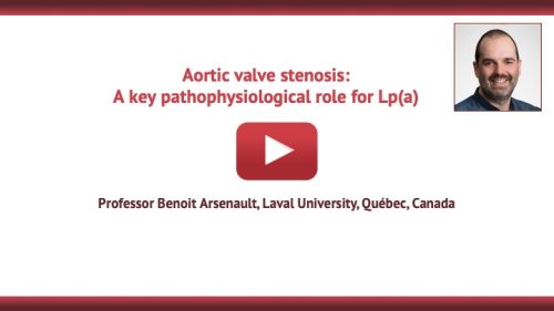 Aortic valve stenosis: A key pathophysilogical role for Lp(a)