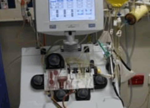 Apheresis machine