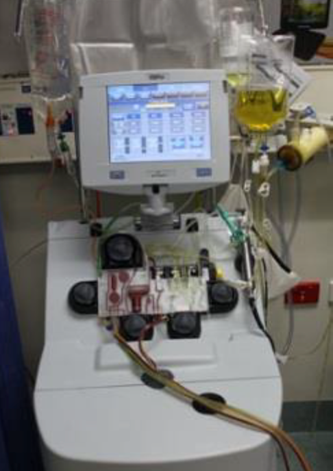 Apheresis machine