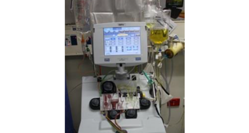 Apheresis machine