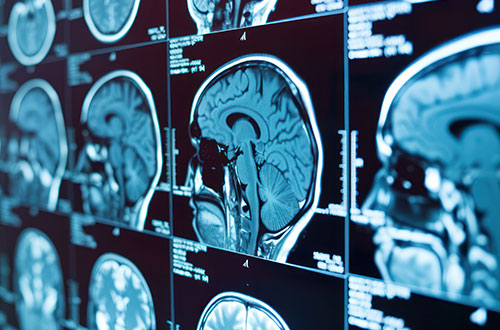 Brain scans